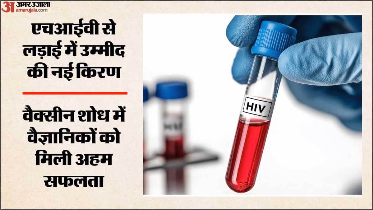 उम्मीद की नई किरण: HIV वैक्सीन की दिशा में बड़ी सफलता, वैज्ञानिकों ने संक्रमण रोकने वाले एंटीबॉडी किए विकसित