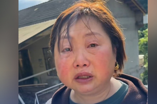 “速效抗衰”不可信 老年人记住“极简护肤”三原则